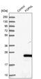 FGFR1OP N-Terminal Like antibody, PA5-59216, Invitrogen Antibodies, Western Blot image 