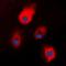 S100 Calcium Binding Protein A1 antibody, orb214550, Biorbyt, Immunocytochemistry image 