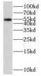 Regulator Of G Protein Signaling 11 antibody, FNab07265, FineTest, Western Blot image 