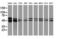 Protein kinase C and casein kinase substrate in neurons protein 3 antibody, LS-C172530, Lifespan Biosciences, Western Blot image 