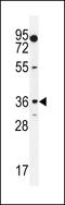 Monoacylglycerol O-Acyltransferase 1 antibody, LS-C164266, Lifespan Biosciences, Western Blot image 