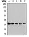 Nicotinamide N-Methyltransferase antibody, orb341145, Biorbyt, Western Blot image 