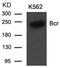 Renal carcinoma antigen NY-REN-26 antibody, AP02709PU-S, Origene, Western Blot image 