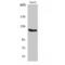 Fibroblast Growth Factor Receptor 1 antibody, LS-C383523, Lifespan Biosciences, Western Blot image 