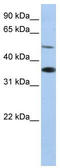 Rh Family B Glycoprotein (Gene/Pseudogene) antibody, TA338417, Origene, Western Blot image 