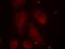 LIM Domain Kinase 1 antibody, GTX50187, GeneTex, Immunocytochemistry image 