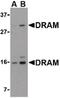 DNA damage-regulated autophagy modulator protein 1 antibody, PA5-20335, Invitrogen Antibodies, Western Blot image 