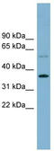 Phospholipid scramblase 3 antibody, TA344791, Origene, Western Blot image 