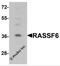 Ras Association Domain Family Member 6 antibody, 6543, ProSci, Western Blot image 