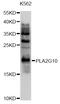 Phospholipase A2 Group X antibody, abx126373, Abbexa, Western Blot image 