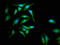 Calcium-binding protein 4 antibody, LS-C674649, Lifespan Biosciences, Immunofluorescence image 