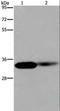 LIM Zinc Finger Domain Containing 1 antibody, LS-C401812, Lifespan Biosciences, Western Blot image 