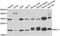 Ribosomal Protein L11 antibody, STJ28490, St John