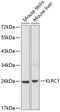 Killer Cell Lectin Like Receptor C1 antibody, GTX66098, GeneTex, Western Blot image 