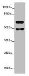 Polypeptide N-Acetylgalactosaminyltransferase 16 antibody, LS-C397766, Lifespan Biosciences, Western Blot image 