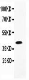 NEDD8 Activating Enzyme E1 Subunit 1 antibody, PB9339, Boster Biological Technology, Western Blot image 