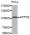 Actinin Alpha 2 antibody, abx002676, Abbexa, Western Blot image 