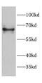 CDK5 Regulatory Subunit Associated Protein 3 antibody, FNab01560, FineTest, Western Blot image 