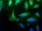 Homer Scaffold Protein 1 antibody, NBP1-44999, Novus Biologicals, Immunofluorescence image 