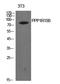 Protein Phosphatase 1 Regulatory Subunit 15B antibody, STJ97266, St John