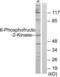 6-Phosphofructo-2-Kinase/Fructose-2,6-Biphosphatase 2 antibody, LS-C118702, Lifespan Biosciences, Western Blot image 