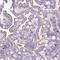 Cathepsin Z antibody, PA5-62072, Invitrogen Antibodies, Immunohistochemistry frozen image 
