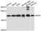 Natriuretic Peptide A antibody, STJ114348, St John