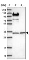 Ribosomal Protein L5 antibody, PA5-60481, Invitrogen Antibodies, Western Blot image 