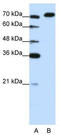 A-Kinase Anchoring Protein 8 Like antibody, TA343734, Origene, Western Blot image 