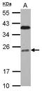 BAF Chromatin Remodeling Complex Subunit BCL7C antibody, LS-C155401, Lifespan Biosciences, Western Blot image 
