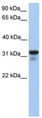 Heparan Sulfate-Glucosamine 3-Sulfotransferase 6 antibody, TA346681, Origene, Western Blot image 