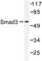 SMAD Family Member 3 antibody, AP06414PU-N, Origene, Western Blot image 