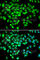 DExD-Box Helicase 21 antibody, A7034, ABclonal Technology, Immunohistochemistry paraffin image 
