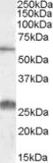 Solute Carrier Family 47 Member 1 antibody, TA305903, Origene, Western Blot image 
