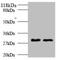 Tryptase Beta 2 (Gene/Pseudogene) antibody, LS-C285631, Lifespan Biosciences, Western Blot image 