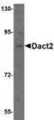 Dishevelled Binding Antagonist Of Beta Catenin 2 antibody, TA306668, Origene, Western Blot image 