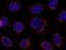 Stromal interaction molecule 1 antibody, NB110-55300, Novus Biologicals, Immunocytochemistry image 