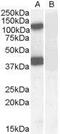 Erythrocyte Membrane Protein Band 4.1 Like 2 antibody, GTX88926, GeneTex, Western Blot image 
