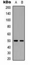 Neuromedin B Receptor antibody, orb334772, Biorbyt, Western Blot image 