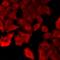 Vacuolar Protein Sorting 4 Homolog A antibody, LS-C668528, Lifespan Biosciences, Immunofluorescence image 