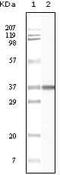 BLK Proto-Oncogene, Src Family Tyrosine Kinase antibody, MA5-15302, Invitrogen Antibodies, Western Blot image 