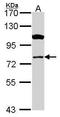 Carnitine Palmitoyltransferase 1A antibody, PA5-29995, Invitrogen Antibodies, Western Blot image 