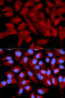 Eukaryotic translation initiation factor 5A-1 antibody, A01727, Boster Biological Technology, Western Blot image 