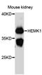 HemK Methyltransferase Family Member 1 antibody, LS-C747742, Lifespan Biosciences, Western Blot image 