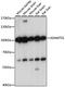 ADAM Metallopeptidase With Thrombospondin Type 1 Motif 1 antibody, GTX66366, GeneTex, Western Blot image 