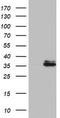 Ornithine Carbamoyltransferase antibody, CF802595, Origene, Western Blot image 
