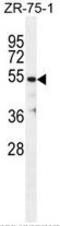 Tubulin Beta 1 Class VI antibody, AP54162PU-N, Origene, Western Blot image 