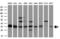 Cytochrome B5 Reductase 2 antibody, M11240, Boster Biological Technology, Western Blot image 