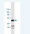 Protein diaphanous homolog 1 antibody, H00001729-M02, Novus Biologicals, Western Blot image 