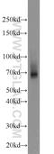 Zinc Finger Protein 354A antibody, 14072-1-AP, Proteintech Group, Western Blot image 